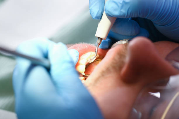 Best Mobile Emergency Dentist in Wheatland, WY