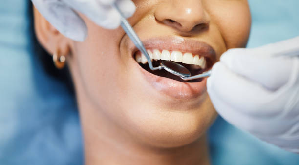 Best Emergency Dentist for Lost Fillings or Crowns in Wheatland, WY