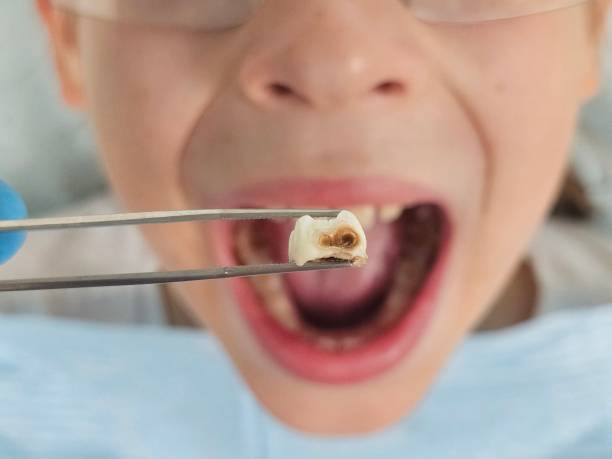 Best Urgent Dental Care for Toothache in Wheatland, WY
